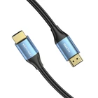 Kép 4/5 - HDMI 2.0 Cable Vention ALHSE, 0,75m, 4K 60Hz, 30AWG (Blue)