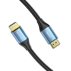Kép 4/5 - HDMI 2.0 Cable Vention ALHSL, 10m, 4K 30Hz, 28 AWG (Blue)