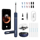 Kép 1/4 - Smart Visual Ear-Clean Rod Bebird Note 5 pro (white)