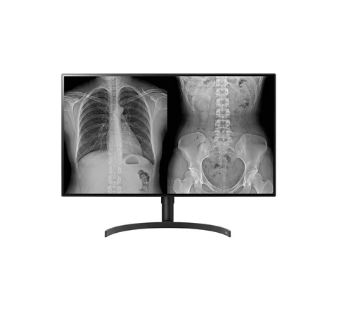 LG 32HL512D-B számítógép monitor 80 cm (31.5") 3840 x 2160 pixelek Full HD Fekete